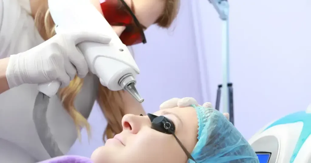face tattoo removal